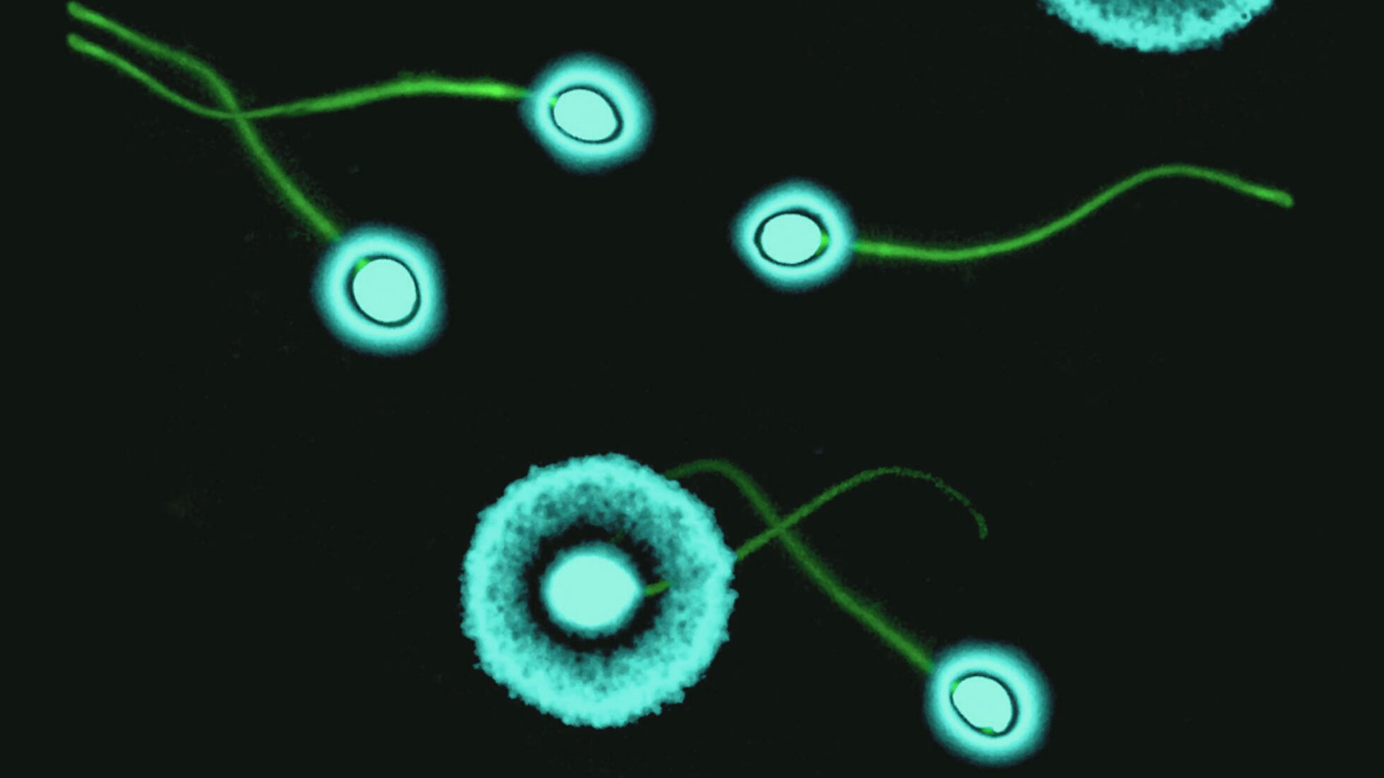 Microscopía artística del laboratorio de andrología
